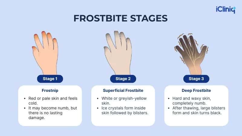 Frostbite franchise Frostbite franchise